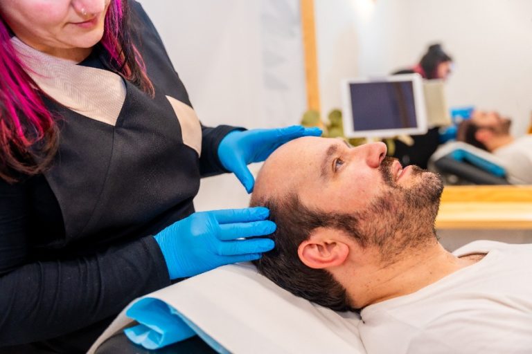 Un chirurgien dessine la ligne frontale sur le cuir chevelu d’un patient avant la greffe