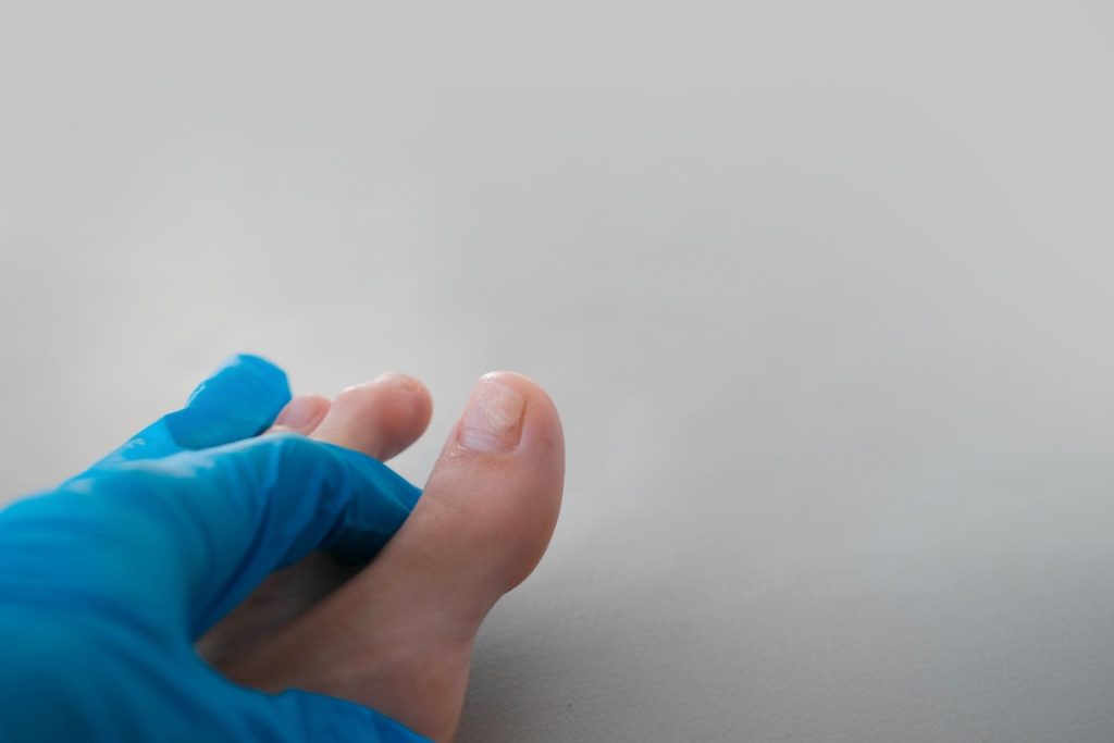 Un médecin qui regarde l'ongle du pieds d'une personne